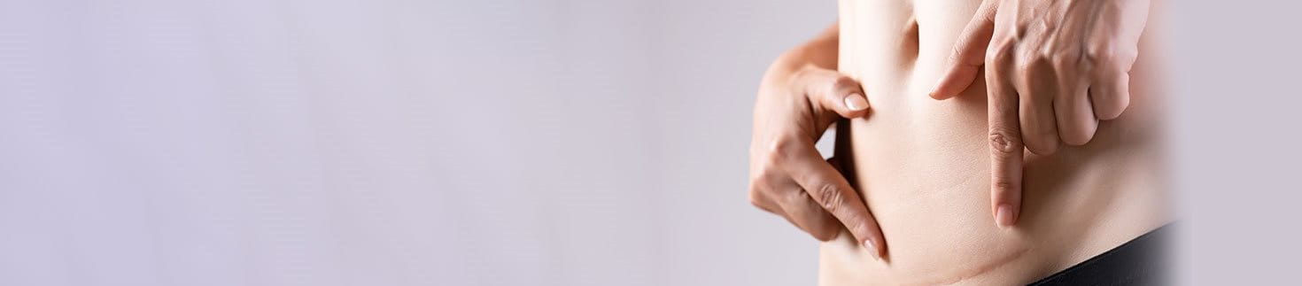 What are Scars? How to Minimize Scarring from Cuts and Wounds