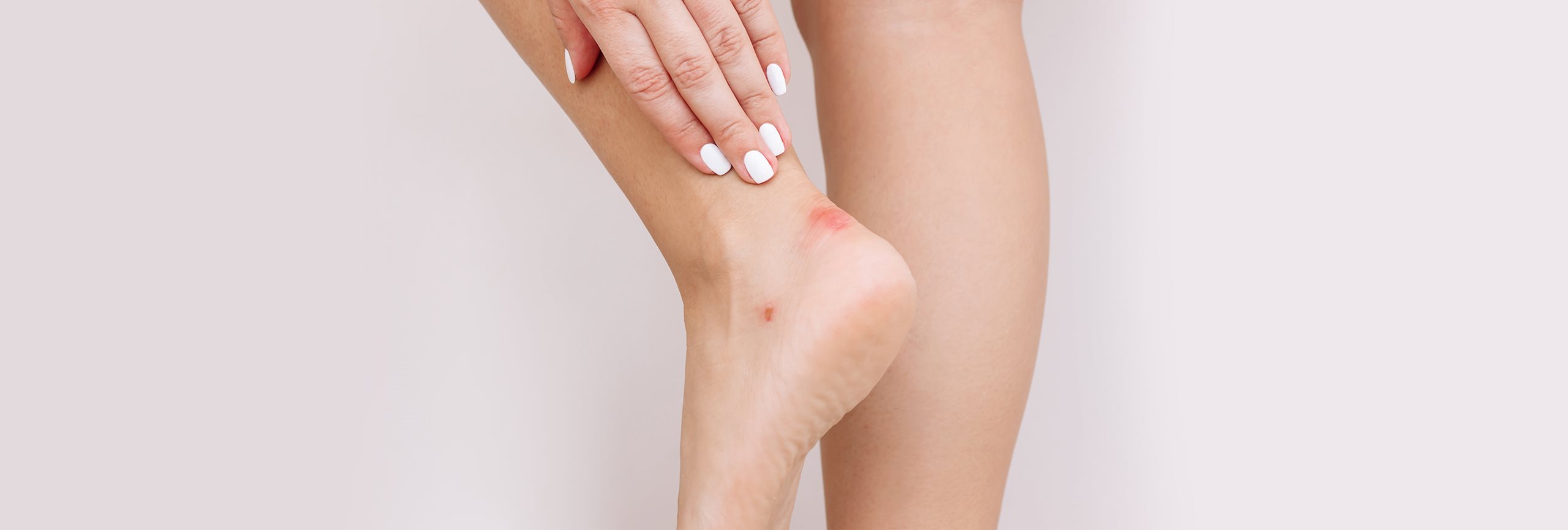 Chica con ampolla en los pies