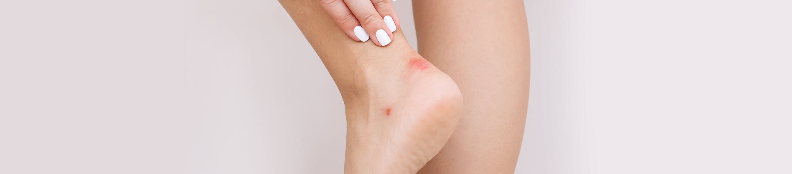 Chica con ampolla en los pies