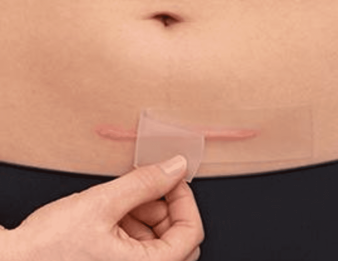 Visualisatie van een litteken