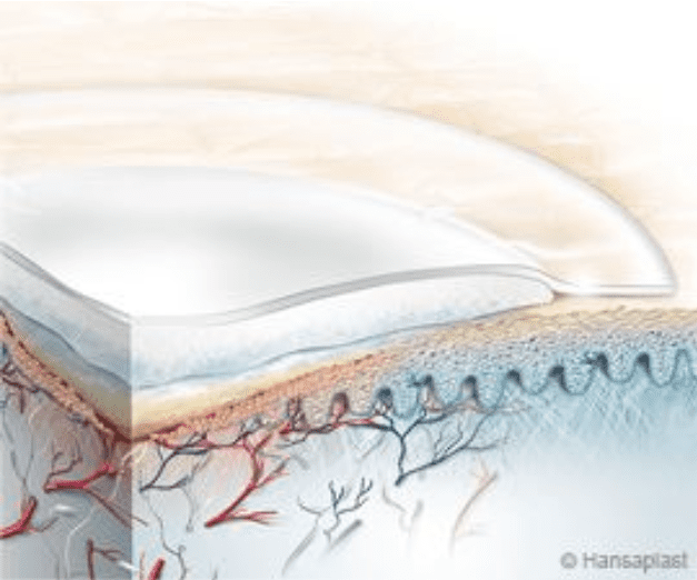 Visualisatie van een wond