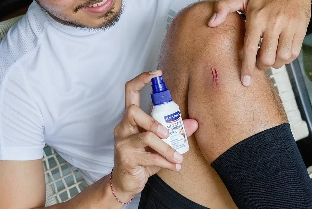 Cara menyembuhkan luka lecet di kaki setelah terjatuh.