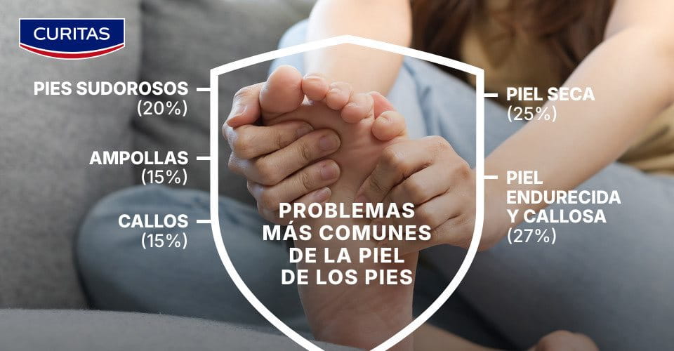 Principales problemas de los pies