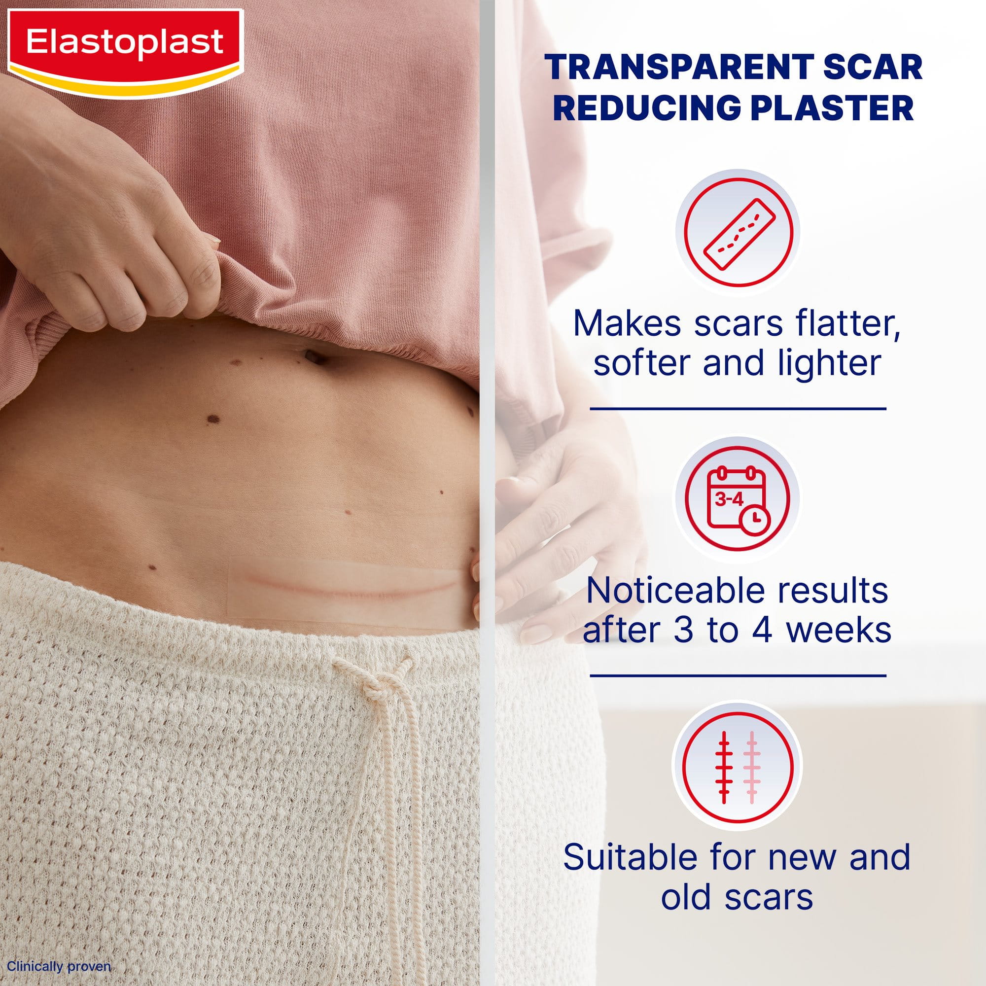 Elastoplast Scar Reducer Patches makes scars flatter, softer, and lighter, noticable results after 3 to 4 weeks, suitable for new and old scars