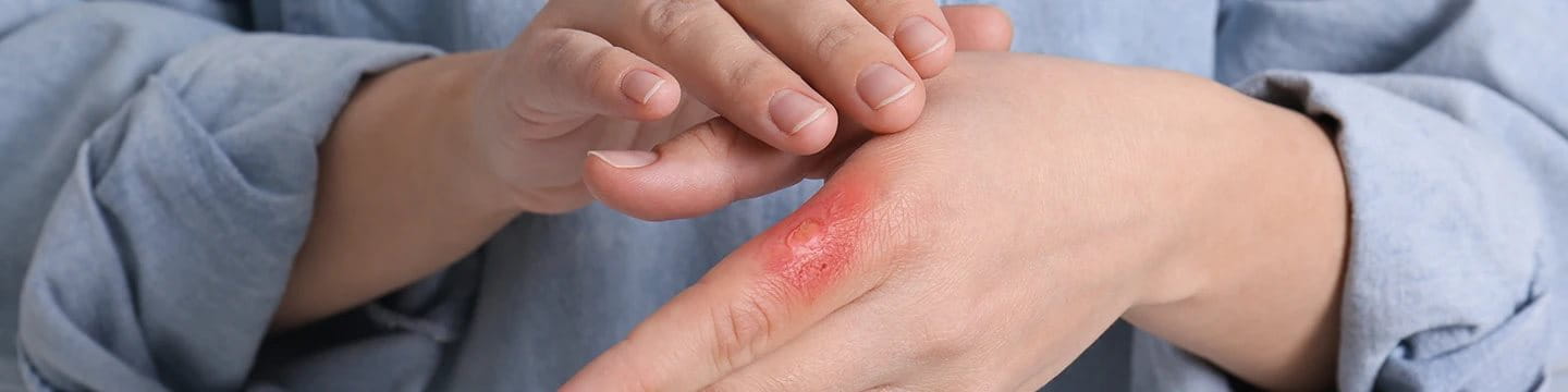 what are the phases of wound healing