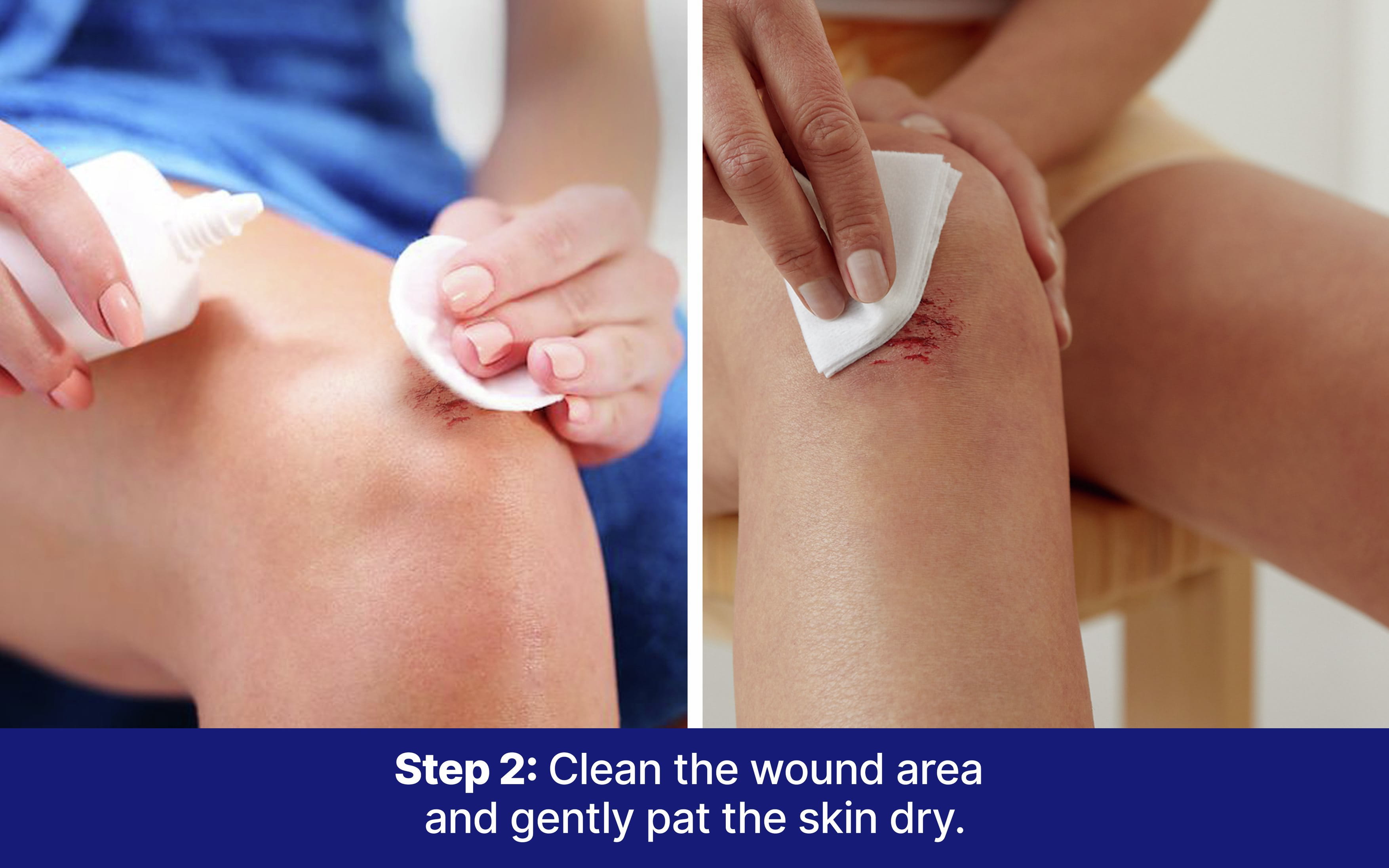 Hansaplast Soft Fixation Tape for Wound Dressing | Skin Friendly | Strong Adhesion | Micropore Tape | Easy to Tear | Germany's No. 1 Brand | Latex Free