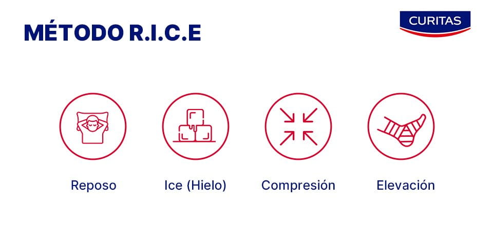 Metodo RICE