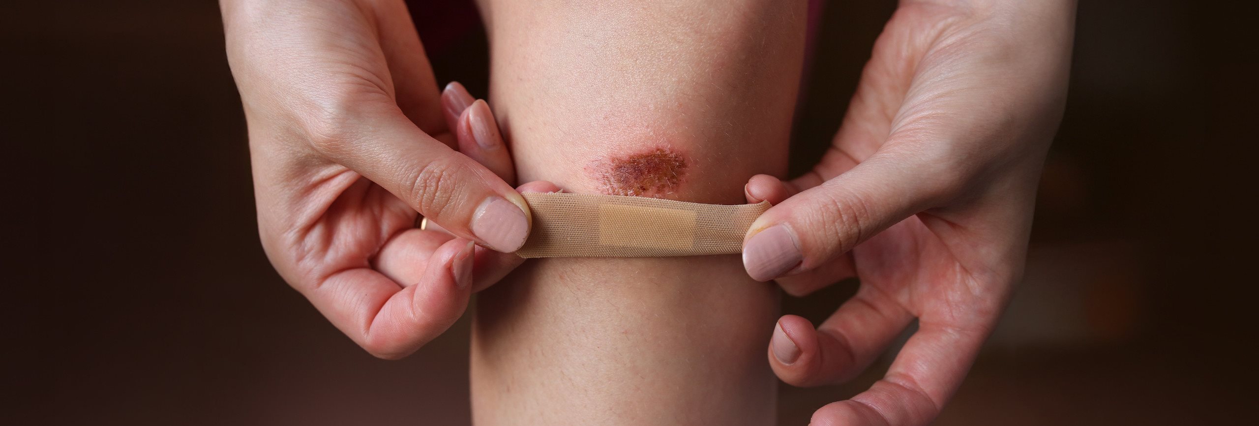 Heridas menores en la piel