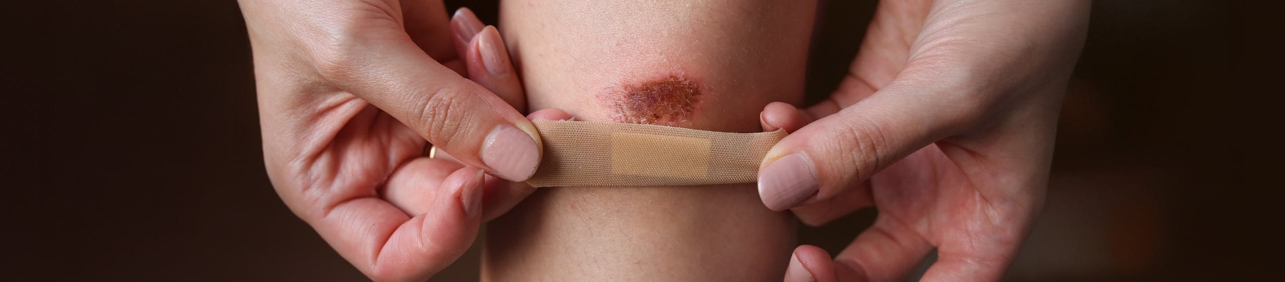 Heridas menores en la piel