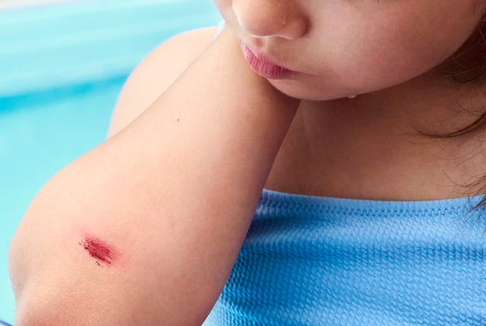 Detailansicht einer Person, die ein Pflaster auf den Zeigefinger klebt.