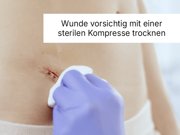 Wunde vorsichtig mit einer sterilen Kompresse trocknen