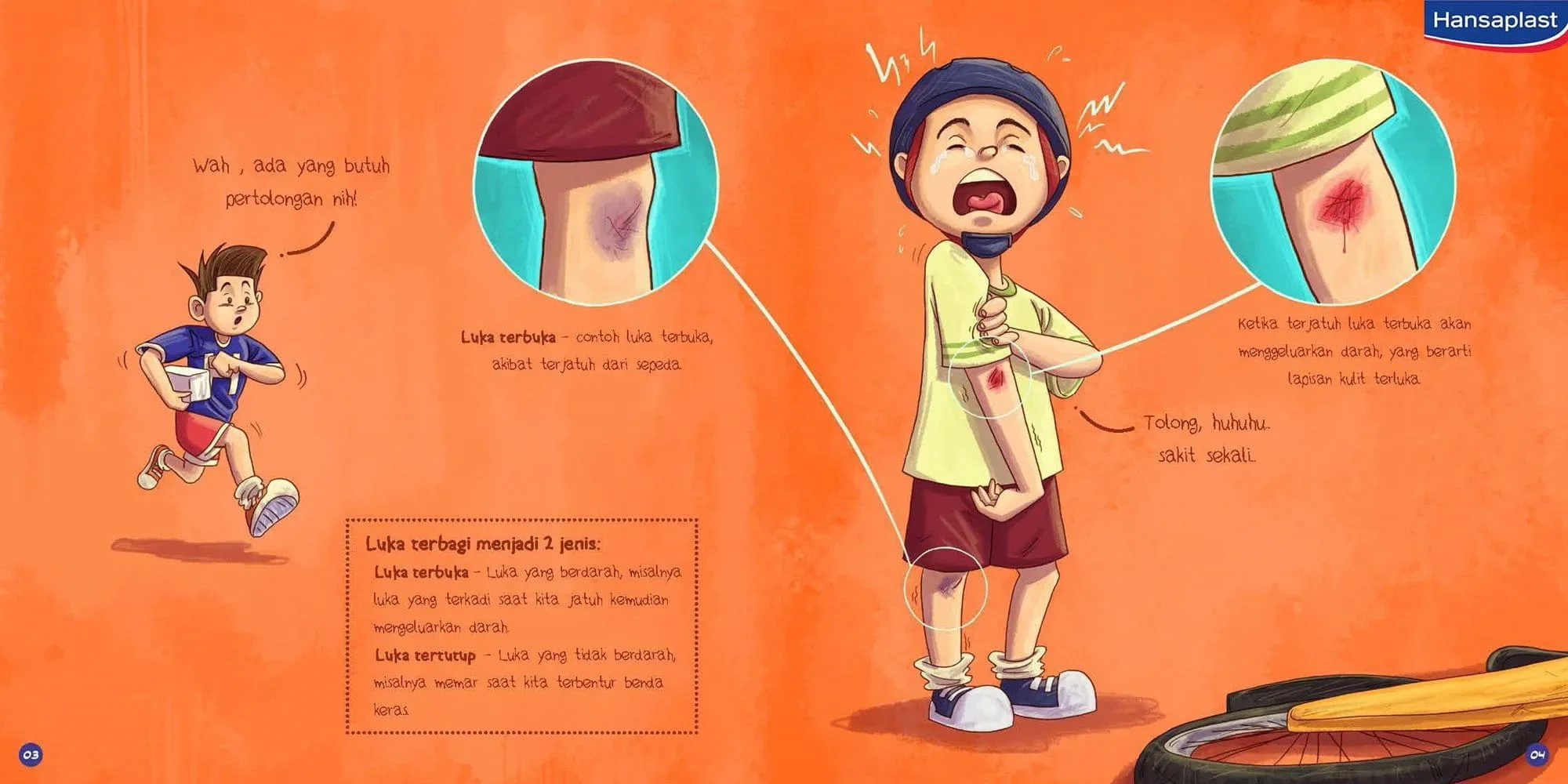 Jenis-jenis luka dijelaskan dengan rinci di buku cerita anak siaga.