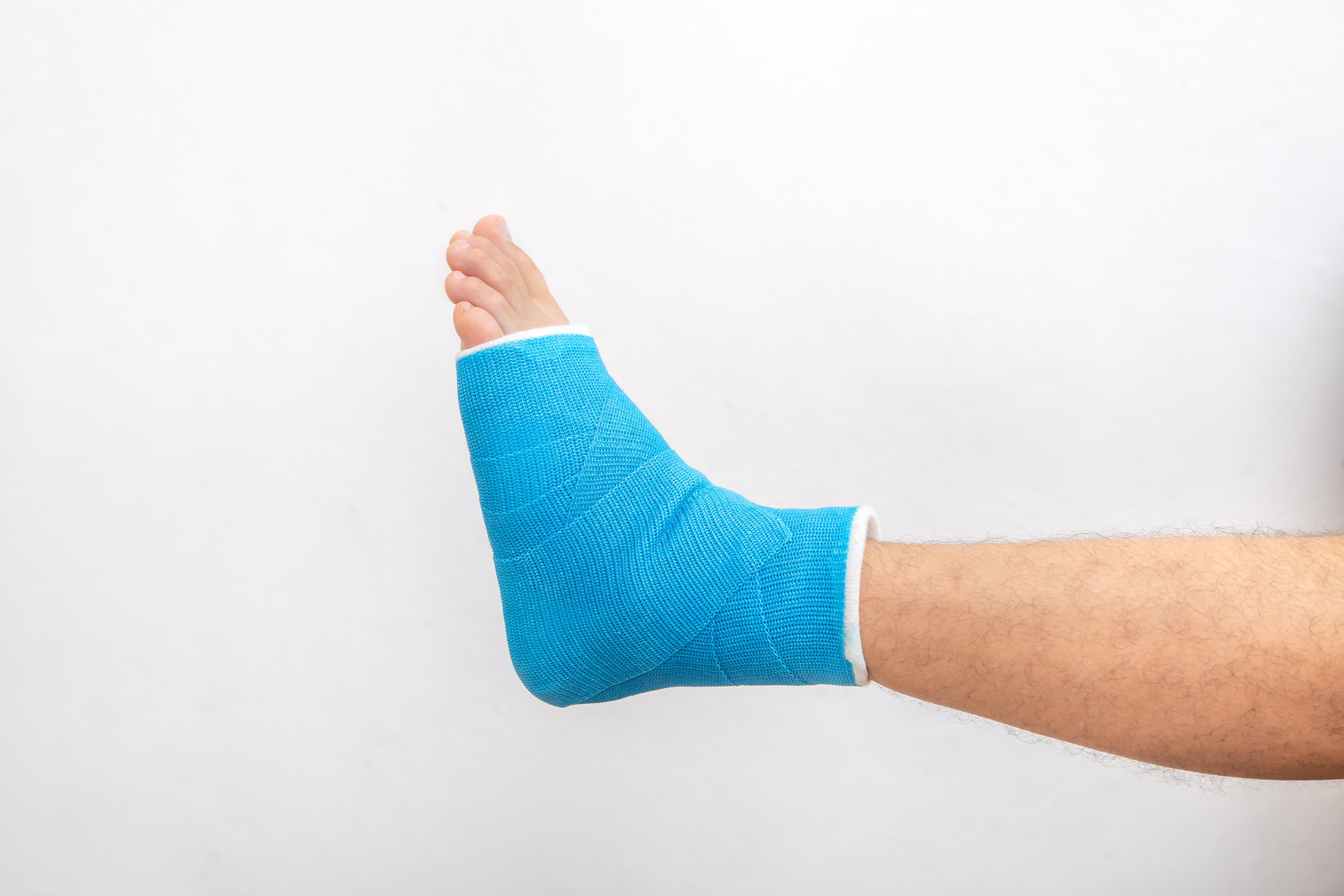 image of a persons leg with a blue cast on their ankle and foot