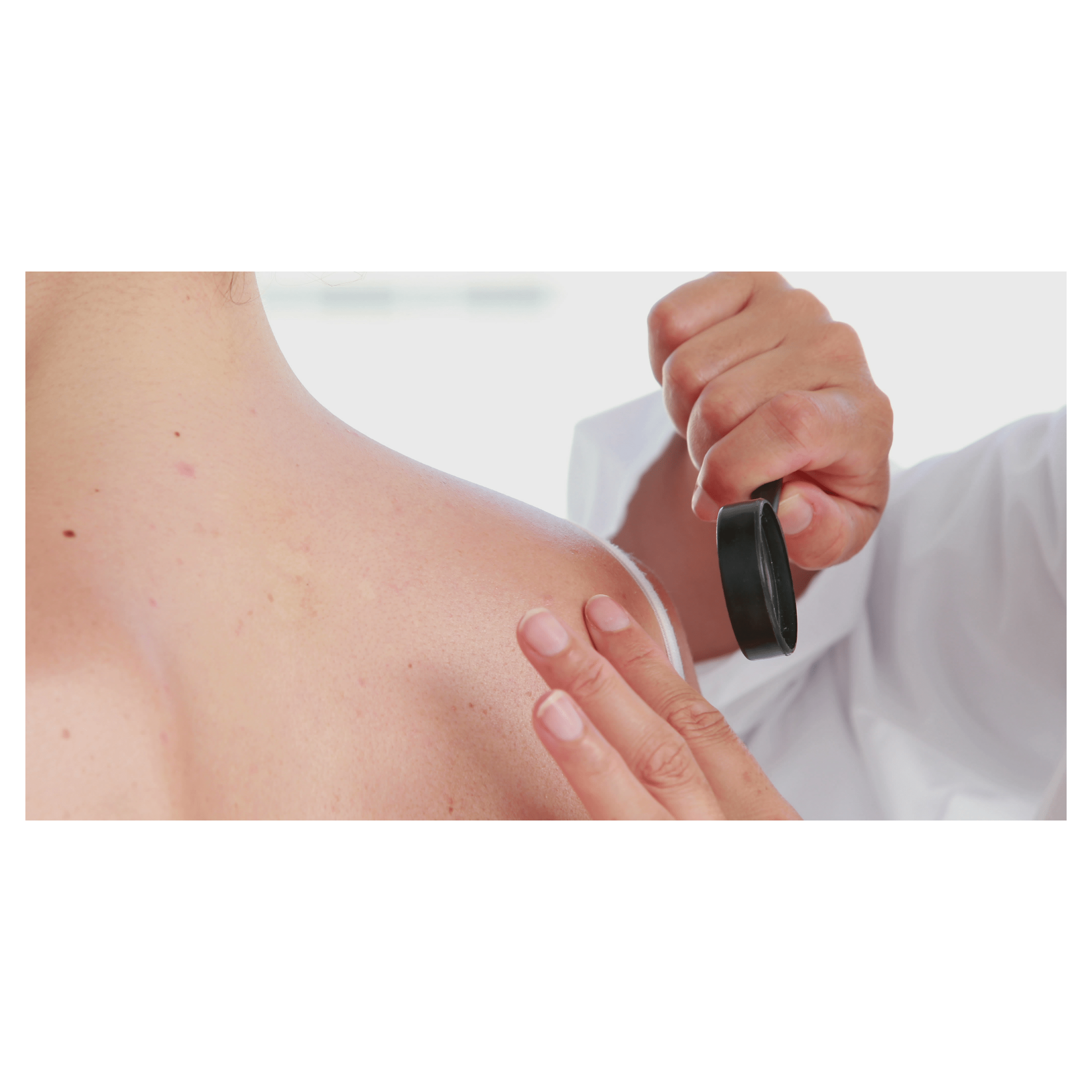 dermatologist inspecting skin