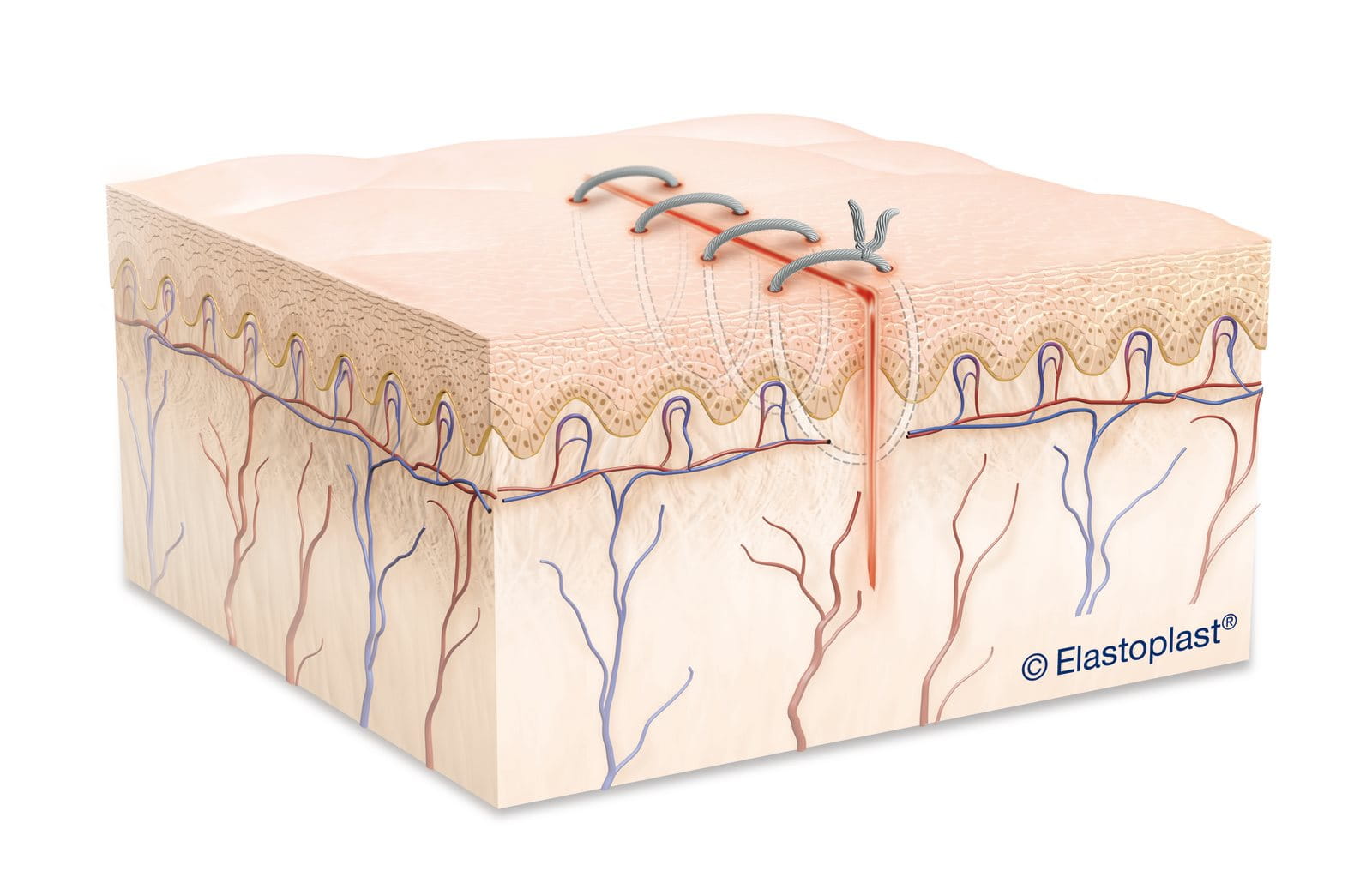 diagram of stitches on a wound