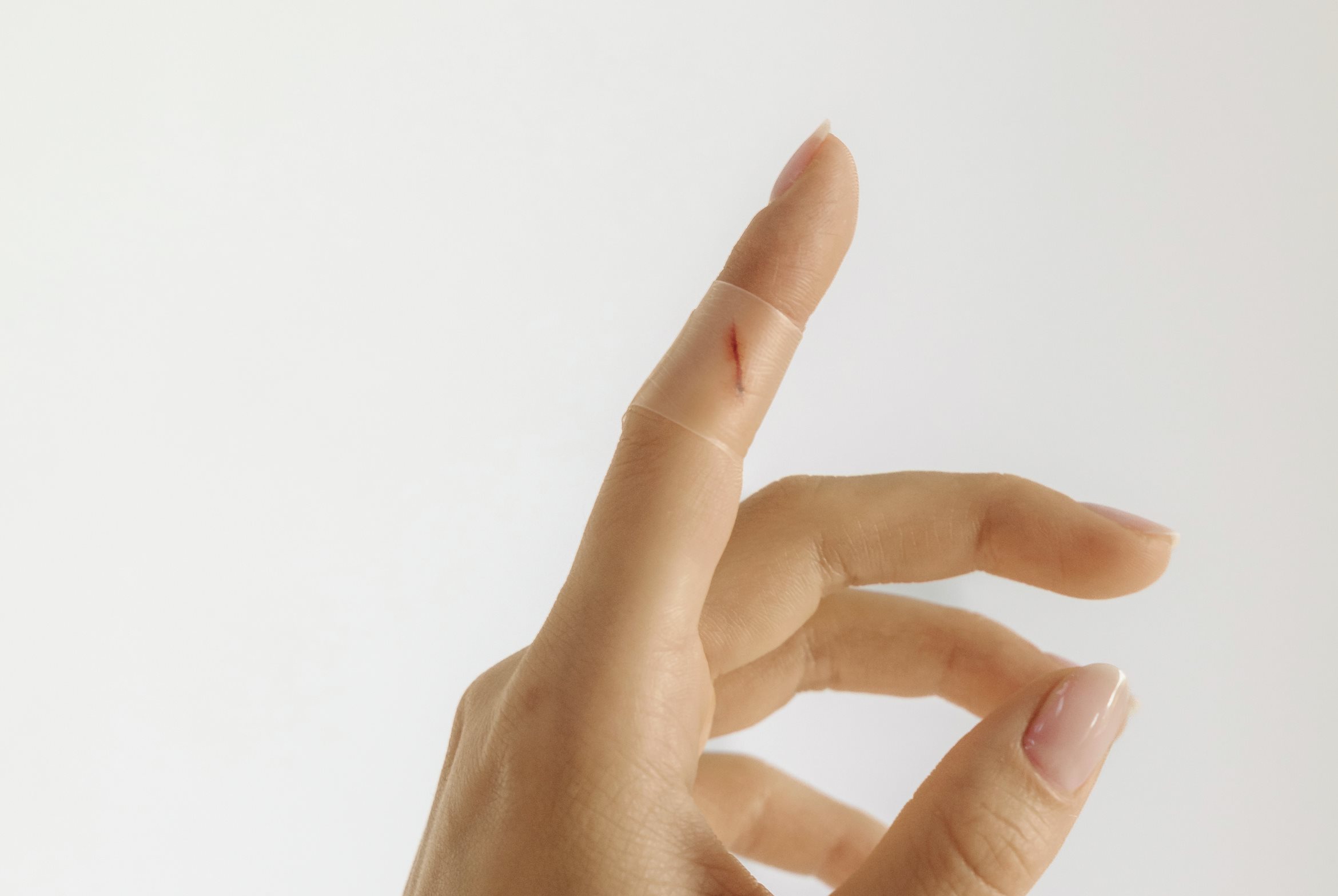 Bild einer Schnittwunde am Finger