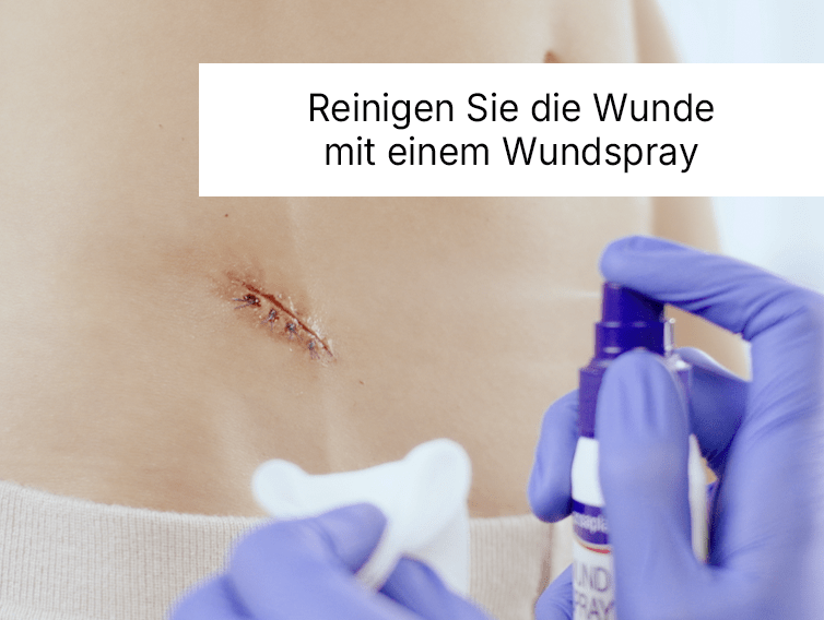 Reinigen Sie die Wunde mit einem Wundspray