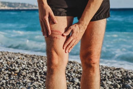 Cómo proteger herida del agua