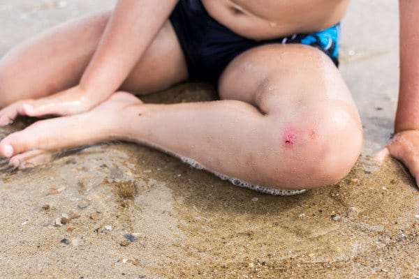 Agua salada y heridas