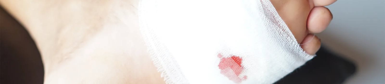 Luka tusuk pada kaki perlu penanganan khusus