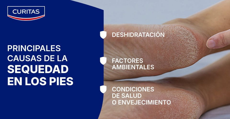 causas de la sequedad en los pies