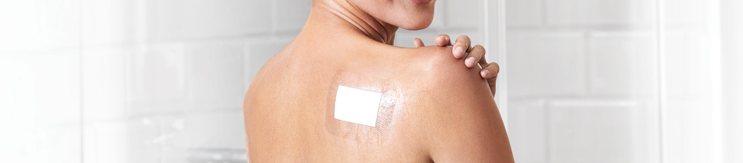heridas postoperatorias