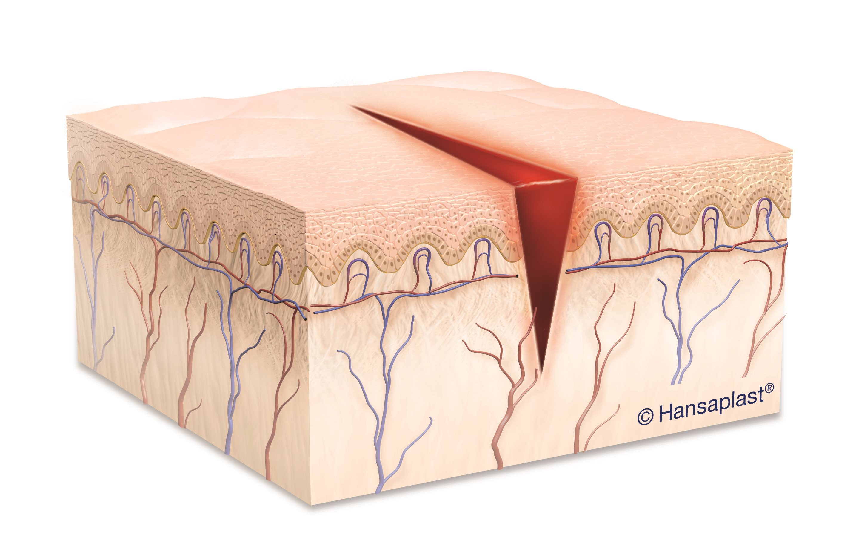 Illustrations Healthy Skin, Laceration and Suture - Surgery