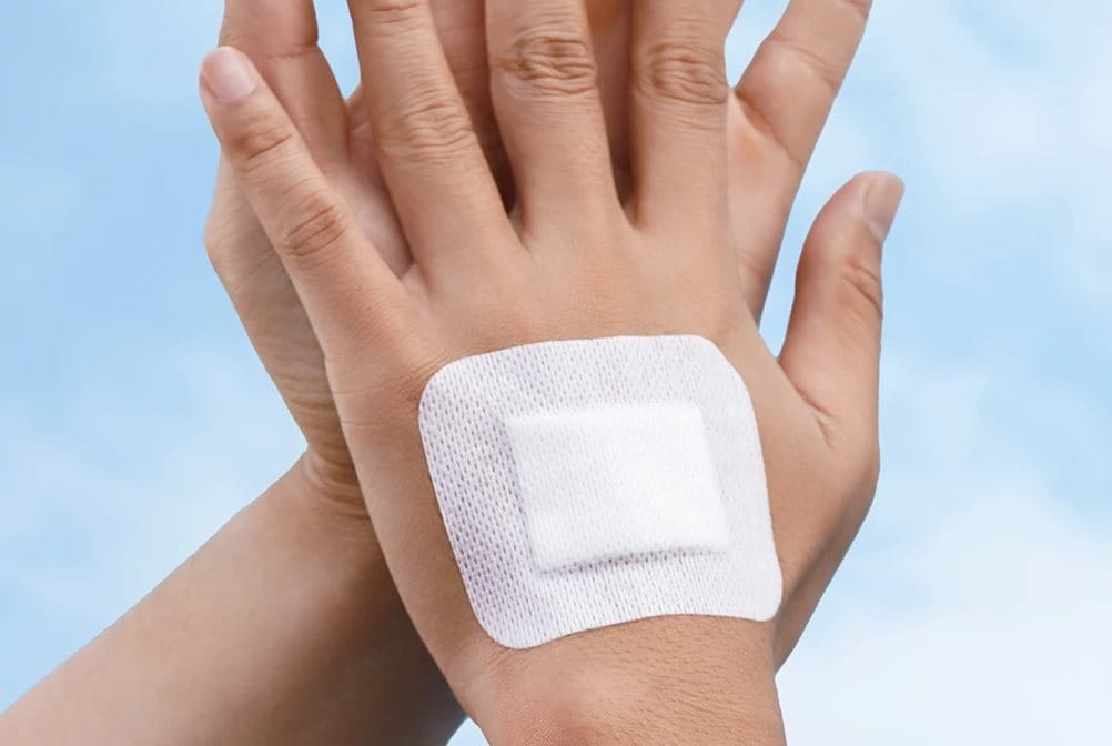 Kenapa perawatan luka lembab lebih baik untuk penyembuhan?