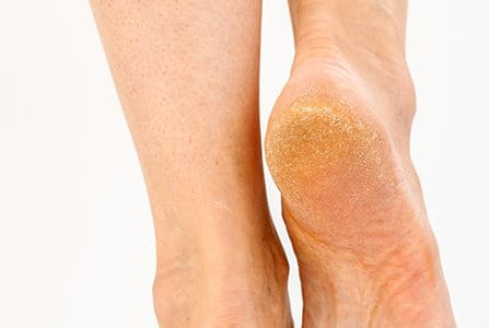 Problemas de los pies