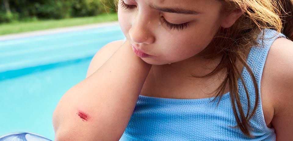Consejos para cuidar una herida en niños