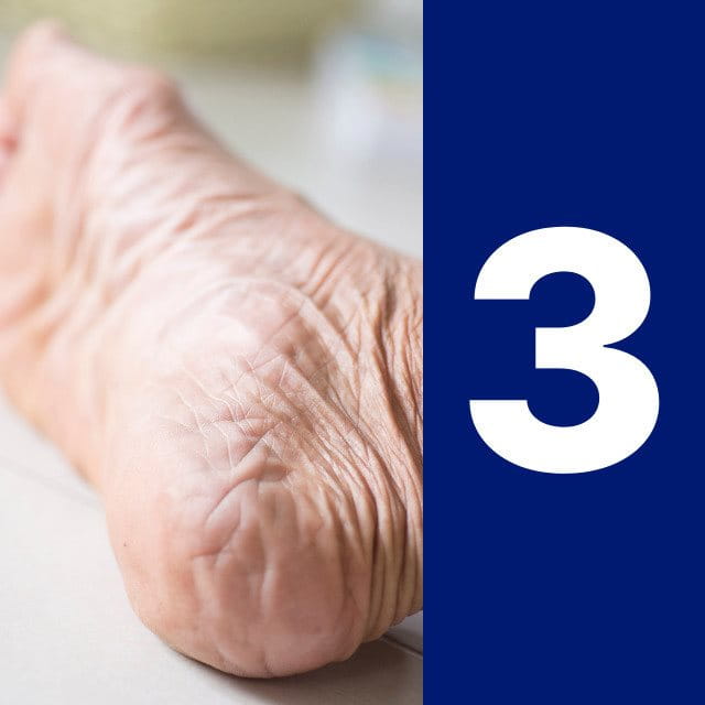 Condiciones de salud o envejecimiento